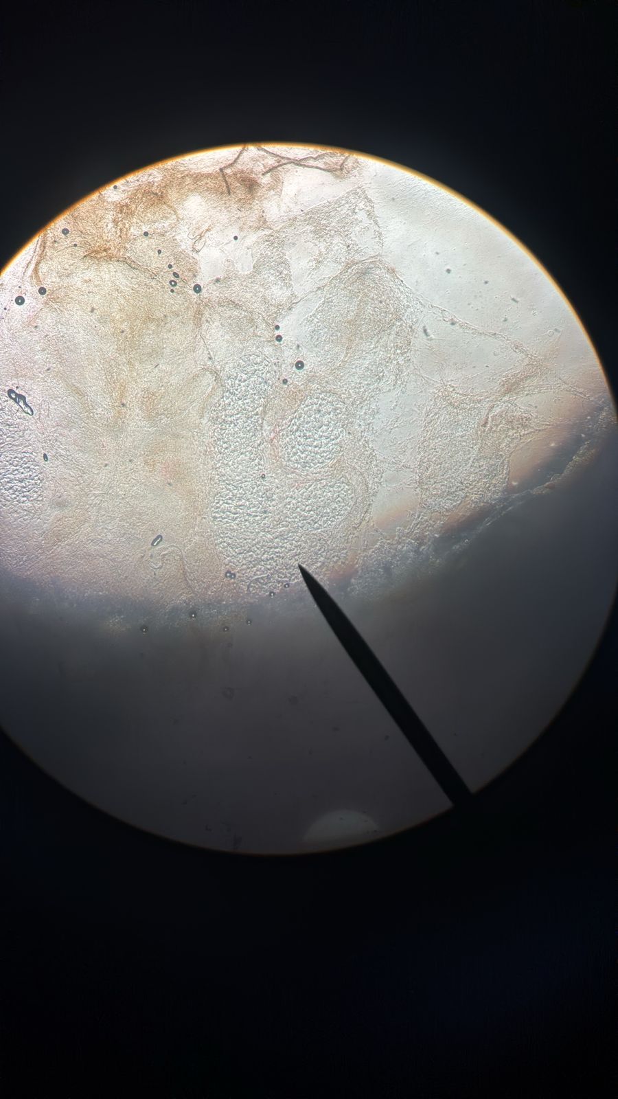 Molusco contagioso: imagen antes